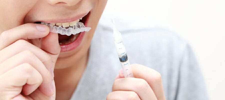 home-whitening03 home-whitening03